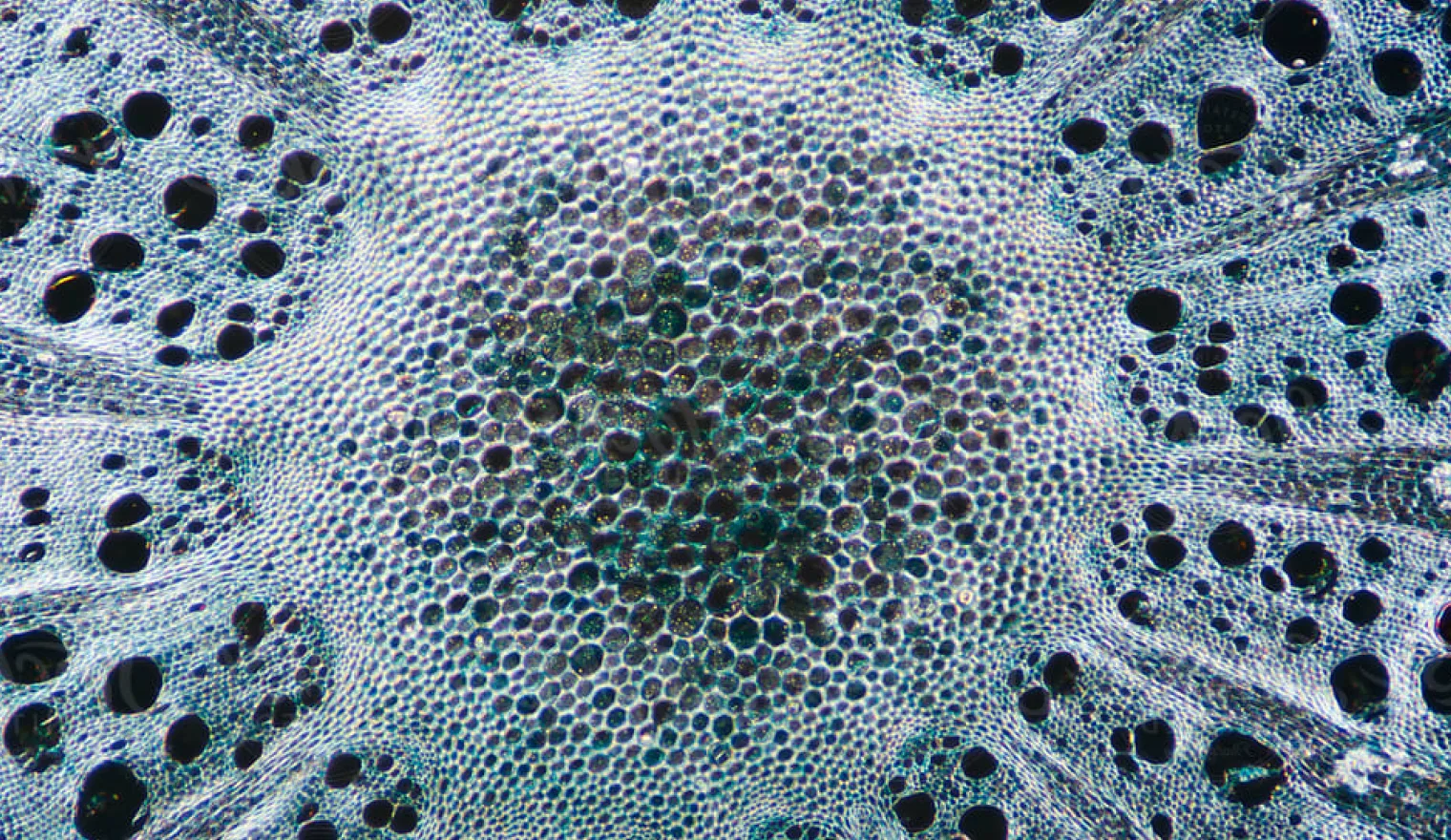 Microscopic cells in teal and white, packed dark and dense at the centre, with large dark openings spread out toward the edges.